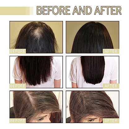 180 ML EELHOE Hair Growth Oil – Natural Rosemary Hair Oil for Dry, Damaged & Thinning Hair (3-Pack) Avelisse