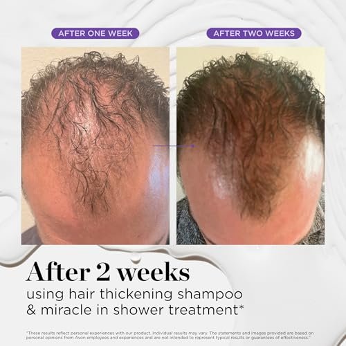 Dr. Groot Scalp Revitalizing Solution Travel Set for Hair Loss - Korean Hair Care with Rosemary Oil, Hair Thickening Shampoo & Miracle In-Shower Treatment, TSA Approved (3-Pack, 1.01 Fl Oz Each) Avelisse