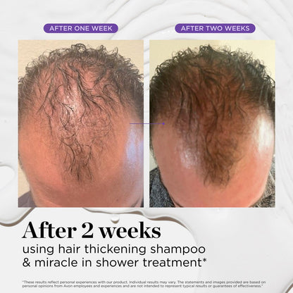 Dr. Groot Scalp Revitalizing Solution Travel Set for Hair Loss - Korean Hair Care with Rosemary Oil, Hair Thickening Shampoo & Miracle In-Shower Treatment, TSA Approved (3-Pack, 1.01 Fl Oz Each) Avelisse