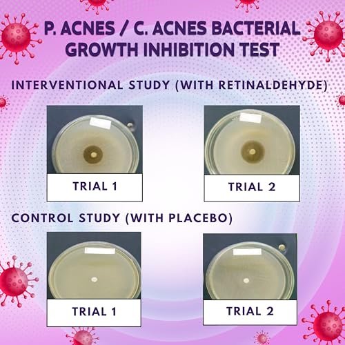 BIO'LEARY FSA HSA Acne Treatment | Anti-Bacterial Pimple Patches | Fast Acne Drying Treatment | Dual Action Acne Patch | Hydrocolloid Spot Cover | Zit Stickers | 72 Counts - görsel 6