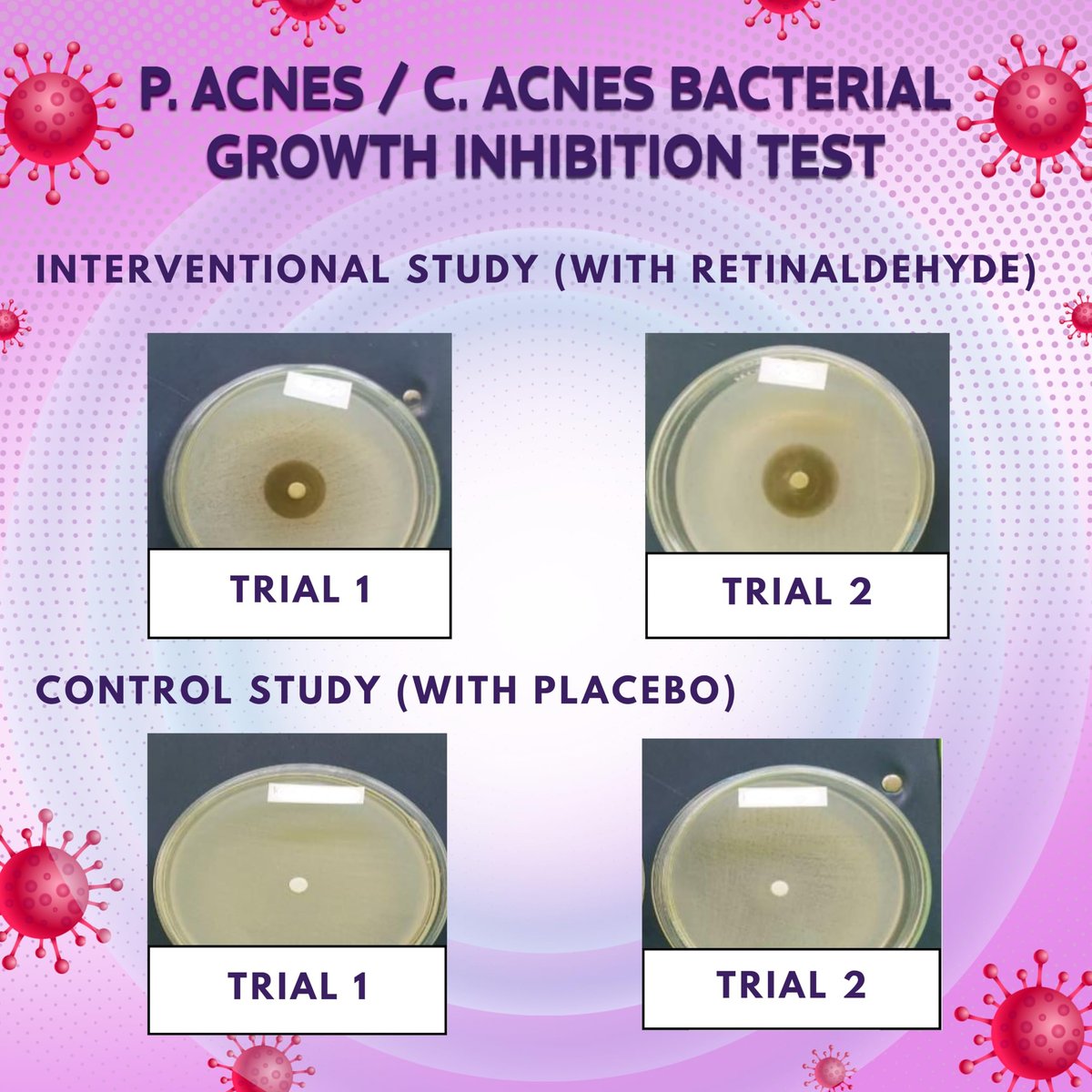 BIO'LEARY FSA HSA Acne Treatment | Anti-Bacterial Pimple Patches | Fast Acne Drying Treatment | Dual Action Acne Patch | Hydrocolloid Spot Cover | Zit Stickers | 72 Counts - görsel 5