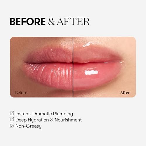 VTCOSMETICS Reedle Shot Lip Plumper - Moisturizing Transparent Lip Gloss, Fragrance-Free, 0.15 oz (4.3 g) - Korean Cosmetics (Expert) Avelisse