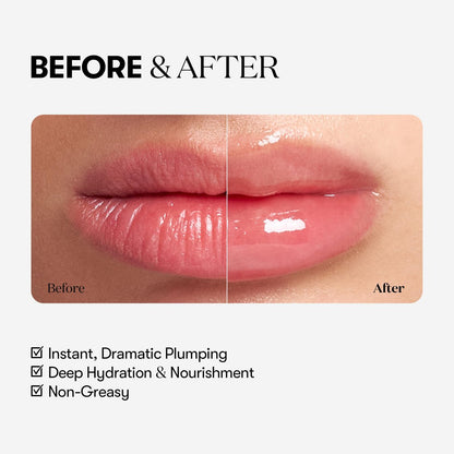VTCOSMETICS Reedle Shot Lip Plumper - Moisturizing Transparent Lip Gloss, Fragrance-Free, 0.15 oz (4.3 g) - Korean Cosmetics (Expert) Avelisse