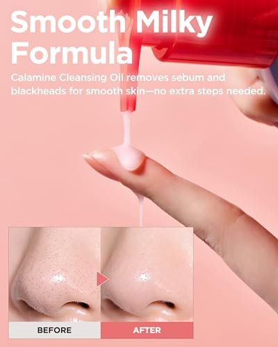 TOCOBO Calamine Pore Control Cleansing Oil – Deep Cleanse Blackheads & Makeup, 200ml Avelisse