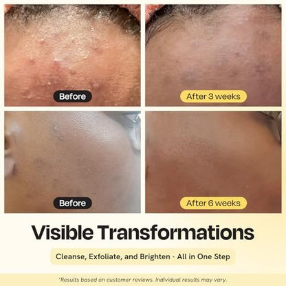 Gleamin Clarifying Brightening Cleanser - 2% Salicylic Acid with Vitamin C, PHA & AHA, Fragrance Free Face Wash for All Skin Types, 3.4 fl oz Avelisse