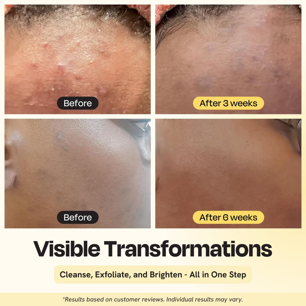 Gleamin Clarifying Brightening Cleanser - 2% Salicylic Acid with Vitamin C, PHA & AHA, Fragrance Free Face Wash for All Skin Types, 3.4 fl oz Avelisse