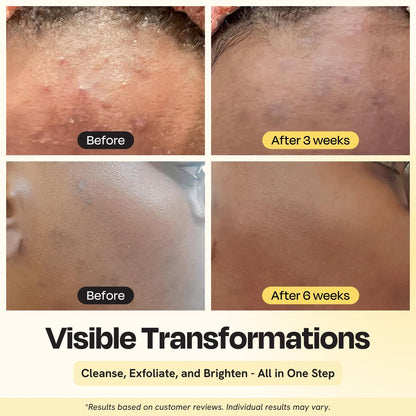 Gleamin Clarifying Brightening Cleanser - 2% Salicylic Acid with Vitamin C, PHA & AHA, Fragrance Free Face Wash for All Skin Types, 3.4 fl oz Avelisse