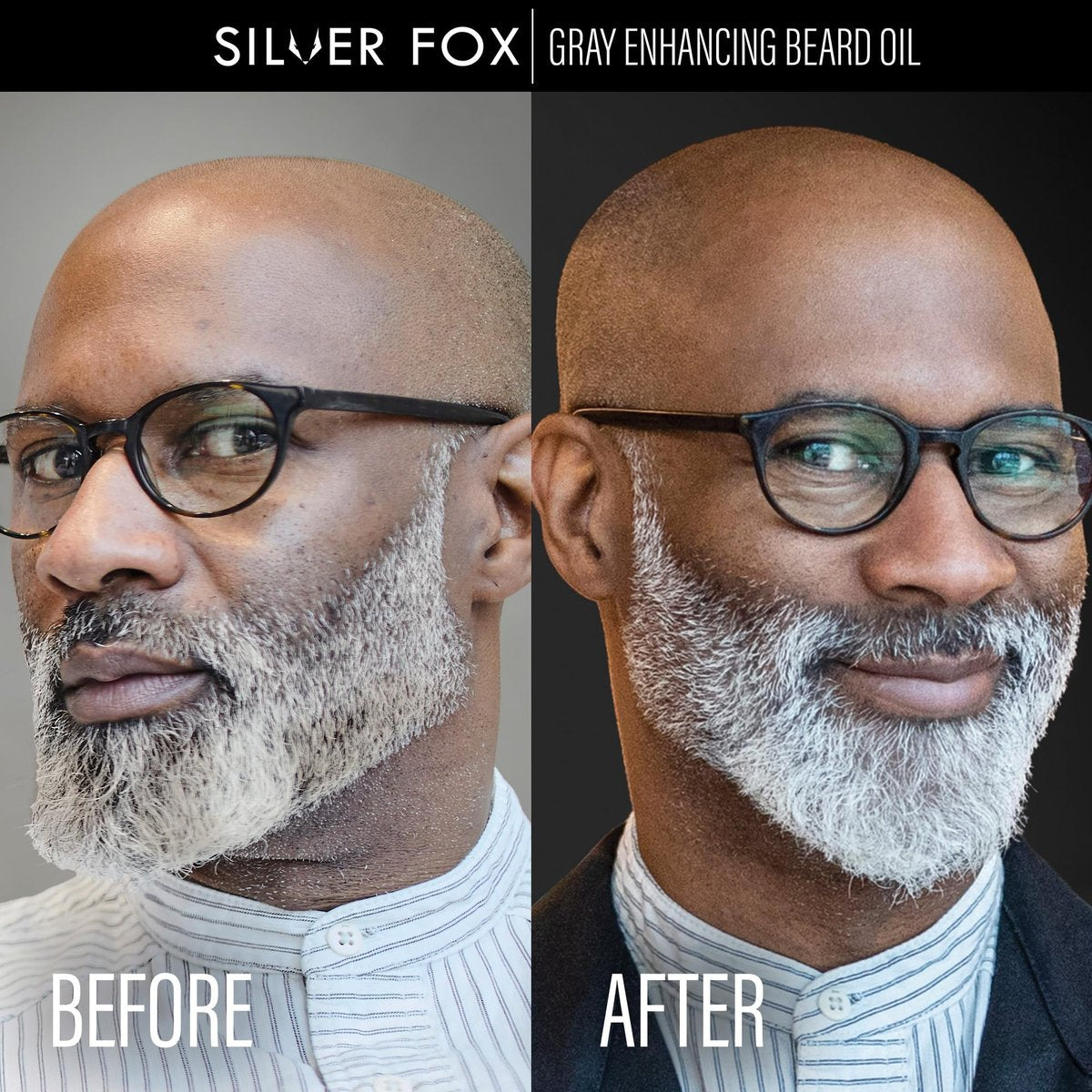 Godefroy Silver Fox Natural Beard Oil for Gray Hair – Shine & Brightness, 0.34 Fl Oz (Pack of 5) Avelisse