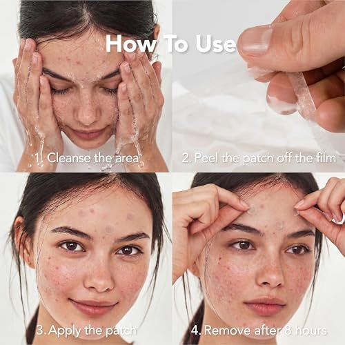 Saplaya K-Beauty Acne Care Hydrocolloid Patches - 100% Hydrocolloid Acne Spot Healing Patch for Pimple Care - görsel 16