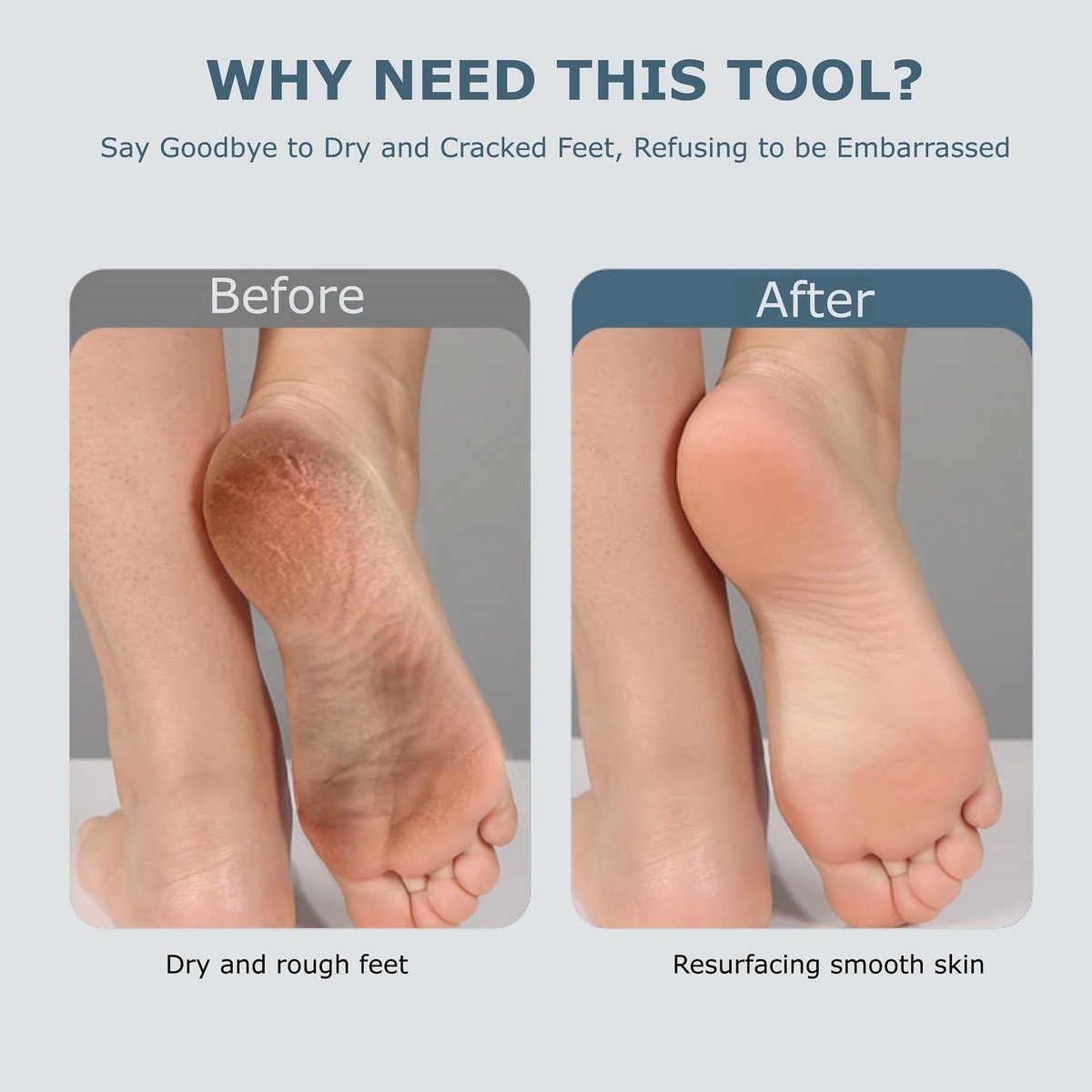 Upgraded Electric Foot Callus Remover – Portable Rechargeable Foot File with 3 Heads for Dry, Cracked Feet Avelisse
