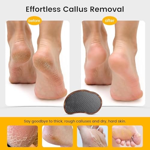 BEZOX Glass Foot File - Nano-Glass Pumice Stone Foot Scrubber, Heel File Callus Remover for Silky Smooth Feet, Portable Pedicure Tool with Walnut Wood Handle Avelisse