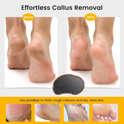 BEZOX Glass Foot File - Nano-Glass Pumice Stone Foot Scrubber, Heel File Callus Remover for Silky Smooth Feet, Portable Pedicure Tool with Walnut Wood Handle Avelisse