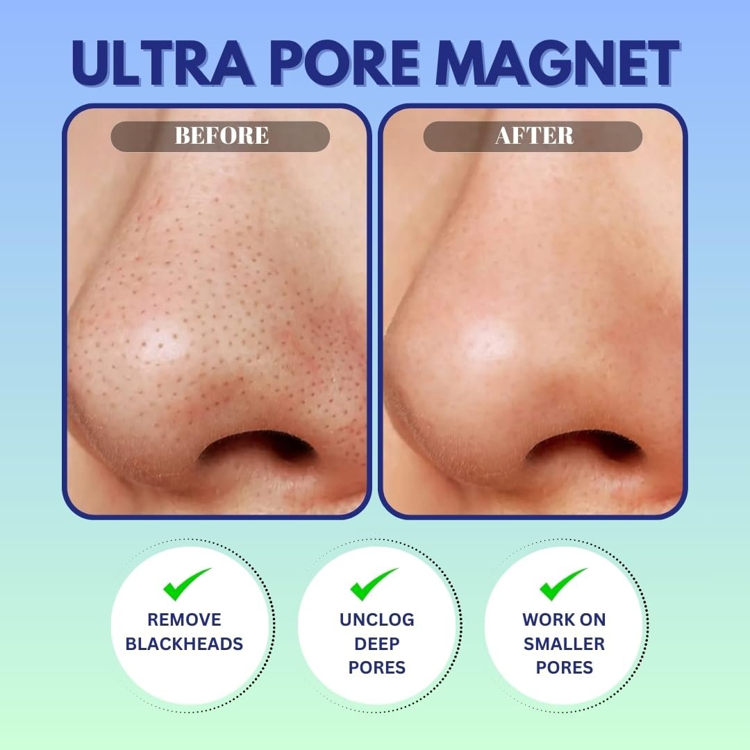 GENDA Blackhead Remover Nose Pore Strips for Deep Cleansing, Hydrocolloid Nose Patches - 12 Strips - görsel 13