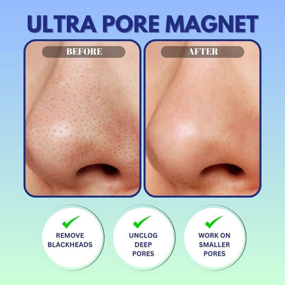 GENDA Blackhead Remover Nose Pore Strips for Deep Cleansing, Hydrocolloid Nose Patches - 12 Strips