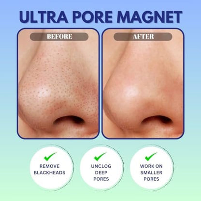 GENDA Blackhead Remover Nose Pore Strips for Deep Cleansing, Hydrocolloid Nose Patches - 12 Strips