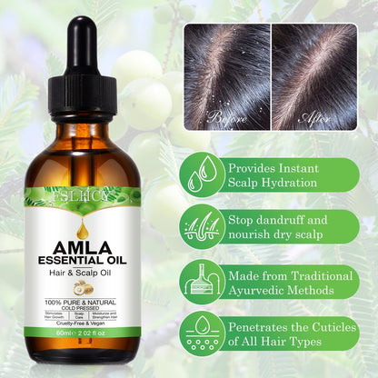 FSLHCY Amla Oil 60ML - Natural & Vegan Hair Oil for Healthy Hair Growth, Promotes Thicker, Fuller, Shinier Hair for Men and Women