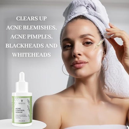 BEE and YOU Acne Treatment with Salicylic Acid, Bee Venom & Propolis Serum - Clear Breakouts, Face & Body, 1 oz