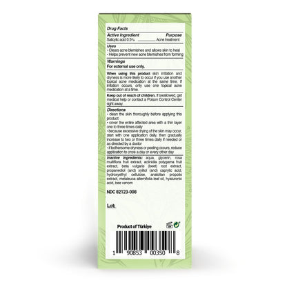 BEE and YOU Acne Treatment with Salicylic Acid, Bee Venom & Propolis Serum - Clear Breakouts, Face & Body, 1 oz