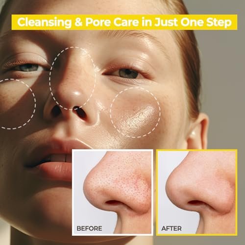 AVCA Jumbo Size Blackhead Remover Cleansing Oil 10.14 fl oz (300ml) – K-Beauty Pore Care Cleanser with PHA, Dissolves Makeup & Sebum, Gentle Exfoliating Oil Cleanser for Oily & Normal Skin Avelisse