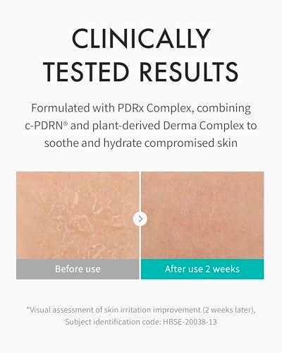 REJURAN Moisture Cream with c-PDRN - Daily Face Moisturizer for Long-Lasting Hydration and Skin Barrier Support, 2.11 oz Avelisse