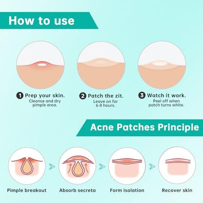 Aquuaera Pimple Patches for Face, Acne Patches Hydrocolloid Patches for Covering Zits and Blemishes, Spot Care for Face, Absorb Fluid, 4 Sizes (210 Count)