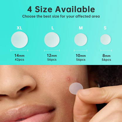 Aquuaera Pimple Patches for Face, Acne Patches Hydrocolloid Patches for Covering Zits and Blemishes, Spot Care for Face, Absorb Fluid, 4 Sizes (210 Count)