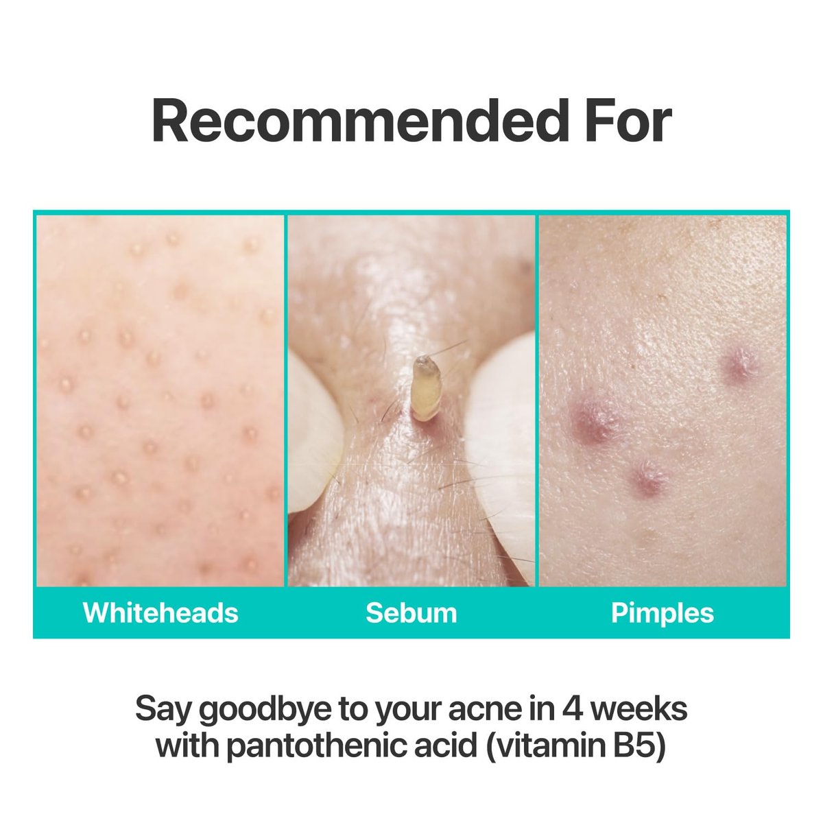 numbuzin No.1 Pantothenic B5 Active Soothing Cream – Remove Sebum & Skin Troubles, Korean Skincare for Women, 2.70 fl oz - görsel 7