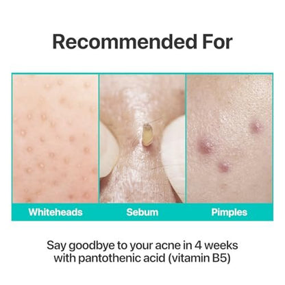 numbuzin No.1 Pantothenic B5 Active Soothing Cream – Remove Sebum & Skin Troubles, Korean Skincare for Women, 2.70 fl oz