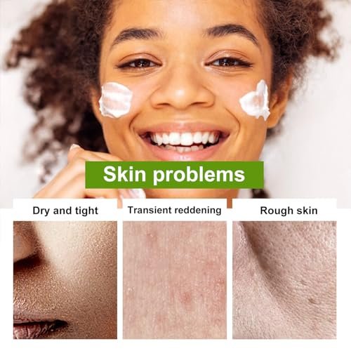 Grospe Aloe Vera Moisturizer Facial Cream – 98% Organic Aloe Vera, Anti-Wrinkle & Deep Hydration for Dry Skin, Acne Scars, 1.7 oz - görsel 6