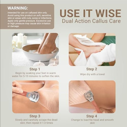 SoleLux Callus Shaver for Feet – 410 Stainless Steel Foot Shaver Callus Remover with 10 Blades, Pain-Free Pedicure Tool for Corns & Dead Skin Removal