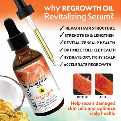 Netwurks Hair & Scalp Bonding Oil – Repair, Moisturize & Promote Hair Growth with Essential Oils (2 Oz)
