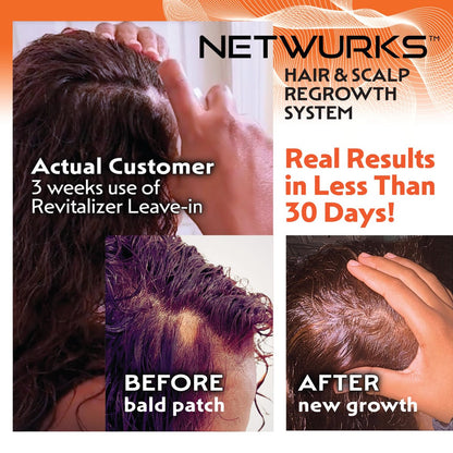 Netwurks Hair & Scalp Bonding Oil – Repair, Moisturize & Promote Hair Growth with Essential Oils (2 Oz)