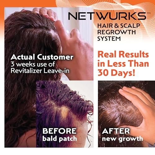 Netwurks Hair & Scalp Bonding Oil – Repair, Moisturize & Promote Hair Growth with Essential Oils (2 Oz) - görsel 16