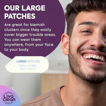60CT Large Pimple Patches with Salicylic Acid, Tea Tree & Calendula Oil - Hydrocolloid Acne Patches for Face & Body - XL Blemish Patch for Chin, Nose, Forehead - LivaClean Avelisse