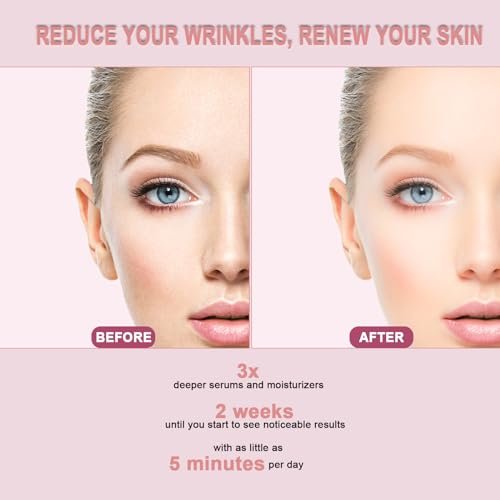 6 in 1 LED Light Therapy Face Wand: Red Light, Microcurrent, Vibration & Thermal Anti-Aging Skincare Tool Avelisse