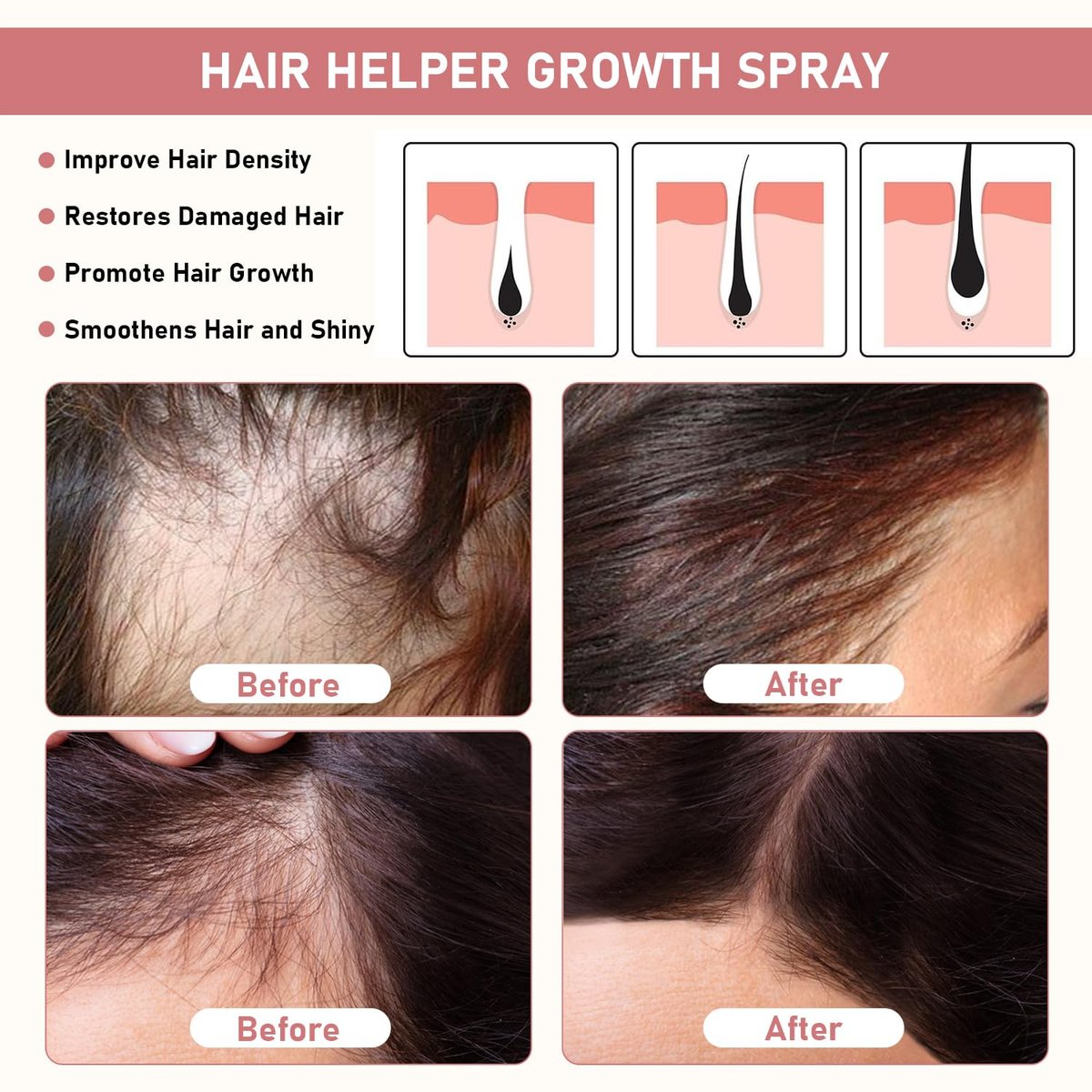 Daioai 2-Pack Natural Rice Water Hair Growth Spray for Thinning Hair - 1.69 Fl Oz Each Avelisse