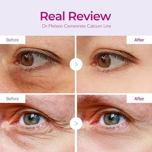 Dr.Melaxin Cemenrete Calcium Volume Eye Patches – 60 Patches for Sagging Skin, Wrinkles, Puffy Eyes & Dark Circles Avelisse