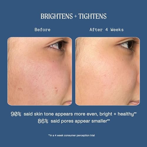 Kinship Dream Wave 2% Bio-Retinoid Overnight Ultra Hydrating Serum - Retinol Alternative for Sensitive Skin, Anti-Aging Niacinamide + Tranexamic Acid, Smooth Wrinkles, Redness Reducing Face Serum, 1 Oz - görsel 12