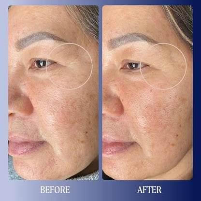 Kinship Dream Wave 2% Bio-Retinoid Overnight Ultra Hydrating Serum - Retinol Alternative for Sensitive Skin, Anti-Aging Niacinamide + Tranexamic Acid, Smooth Wrinkles, Redness Reducing Face Serum, 1 Oz