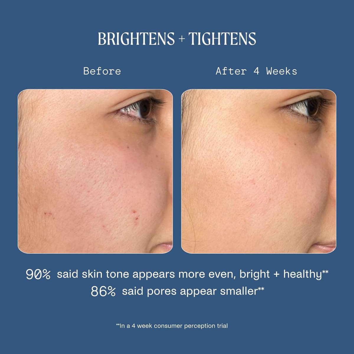 Kinship Dream Wave 2% Bio-Retinoid Overnight Ultra Hydrating Serum - Retinol Alternative for Sensitive Skin, Anti-Aging Niacinamide + Tranexamic Acid, Smooth Wrinkles, Redness Reducing Face Serum, 1 Oz - görsel 11