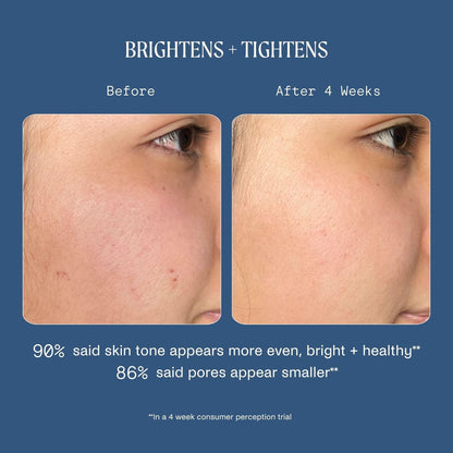 Kinship Dream Wave 2% Bio-Retinoid Overnight Ultra Hydrating Serum - Retinol Alternative for Sensitive Skin, Anti-Aging Niacinamide + Tranexamic Acid, Smooth Wrinkles, Redness Reducing Face Serum, 1 Oz
