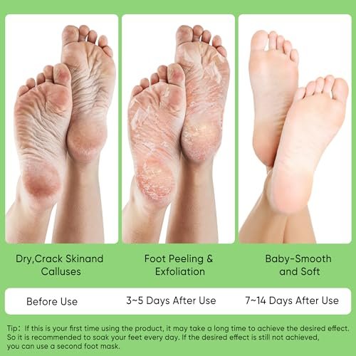 Berlaney Aloe Vera Foot Peeling Mask - Baby Feet Exfoliating Peel for Dead Skin Removal & Moisturizing Care, Dry Cracked Heels Relief, Softening Rough Feet Spa Socks, 3 Pairs Pack (Unisex) Avelisse