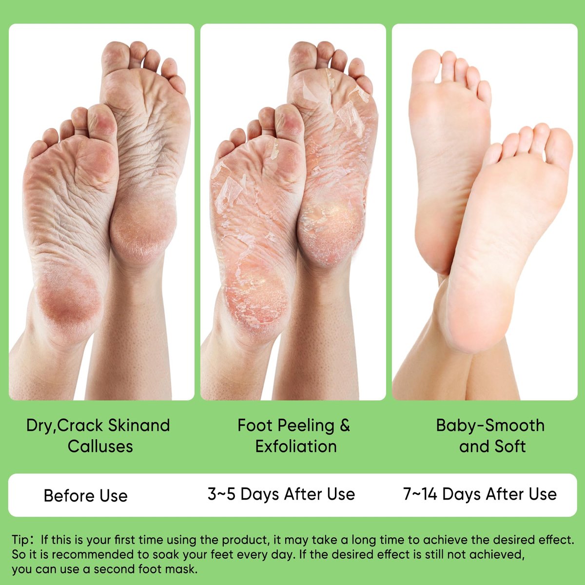 Berlaney Aloe Vera Foot Peeling Mask - Baby Feet Exfoliating Peel for Dead Skin Removal & Moisturizing Care, Dry Cracked Heels Relief, Softening Rough Feet Spa Socks, 3 Pairs Pack (Unisex) Avelisse