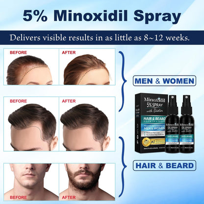 5% Minoxidil for Men and Women Hair Growth Spray - Effective Hair Regrowth Treatment for Thinning Hair and Beard (Pack of 2)