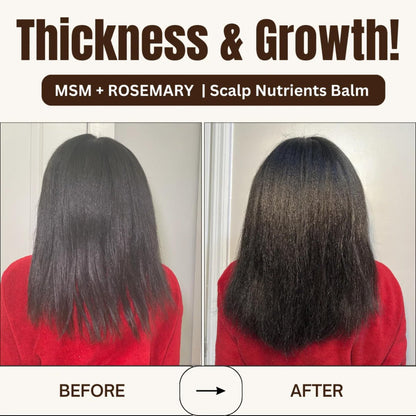 Qhemet Biologics MSM + Rosemary Scalp Nutrients Balm | Food for Hair Growth | MSM, Rosemary, Bhringraj, Castor Oil & Coconut Oil | For Dry Scalp, Thinning & Slow Growth | Vegan (4 oz) Avelisse