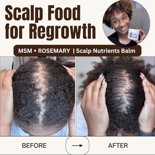 Qhemet Biologics MSM + Rosemary Scalp Nutrients Balm | Food for Hair Growth | MSM, Rosemary, Bhringraj, Castor Oil & Coconut Oil | For Dry Scalp, Thinning & Slow Growth | Vegan (4 oz) Avelisse
