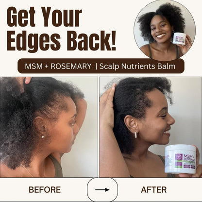 Qhemet Biologics MSM + Rosemary Scalp Nutrients Balm | Food for Hair Growth | MSM, Rosemary, Bhringraj, Castor Oil & Coconut Oil | For Dry Scalp, Thinning & Slow Growth | Vegan (4 oz) Avelisse