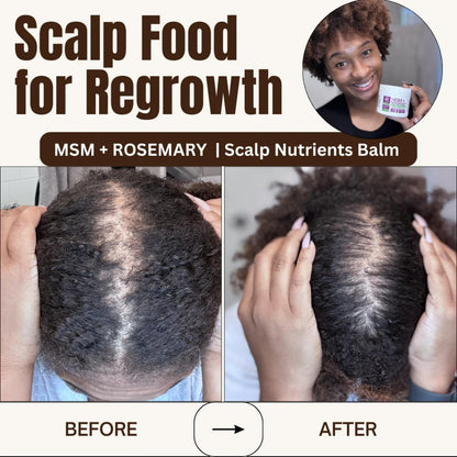 Qhemet Biologics MSM + Rosemary Scalp Nutrients Balm | Food for Hair Growth | MSM, Rosemary, Bhringraj, Castor Oil & Coconut Oil | For Dry Scalp, Thinning & Slow Growth | Vegan (4 oz) Avelisse