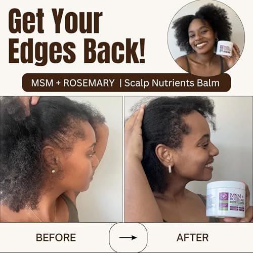 Qhemet Biologics MSM + Rosemary Scalp Nutrients Balm | Food for Hair Growth | MSM, Rosemary, Bhringraj, Castor Oil & Coconut Oil | For Dry Scalp, Thinning & Slow Growth | Vegan (4 oz) Avelisse
