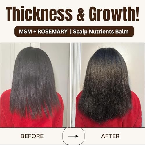 Qhemet Biologics MSM + Rosemary Scalp Nutrients Balm | Food for Hair Growth | MSM, Rosemary, Bhringraj, Castor Oil & Coconut Oil | For Dry Scalp, Thinning & Slow Growth | Vegan (4 oz) Avelisse